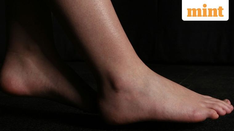 Swollen ankles, cold feet, numbness? Doctor lists 7 leg signs that may reveal hidden heart trouble