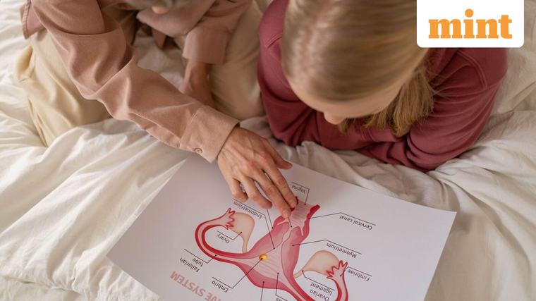 PCOS, endometriosis or ovarian cancer? Doctors explain the overlapping symptoms