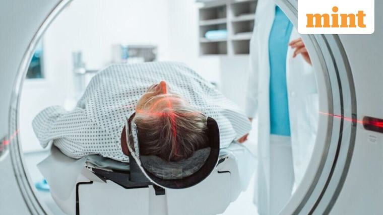 The 30-something brain fog: Why our grey matter is burning out decades too early